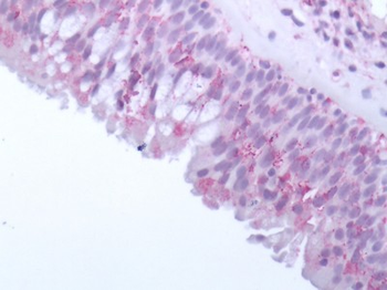 OR10J5 Antibody