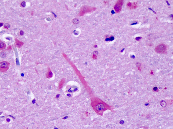 GPR75 Antibody