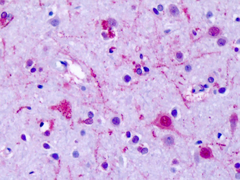 GPR75 Antibody