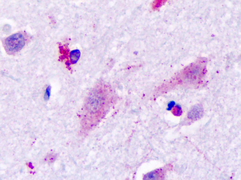 HRH3/Histamine 3 Receptor Antibody