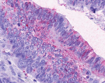CCKAR/CCK1R Antibody