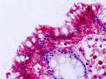 NPFF2/NPFFR2 Antibody