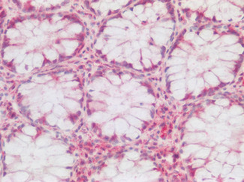 HTR1F/5-HT1F Receptor Antibody