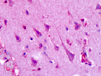 HTR1F/5-HT1F Receptor Antibody