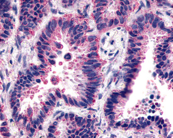 FZD2/Frizzled 2 Antibody