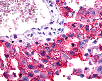 FZD2/Frizzled 2 Antibody