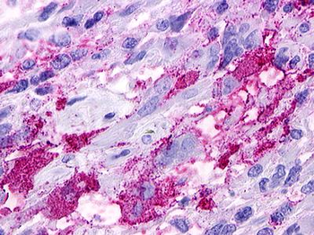 GPR52 Antibody