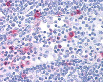 CCR4 Antibody