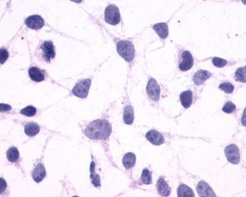 GPR44/CRTH2 Antibody