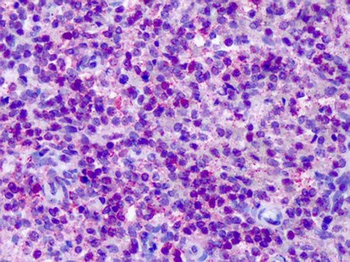 CNR2/CB2 Antibody