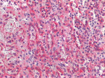 CCR6 Antibody