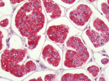 P2RY1/P2Y1 Antibody