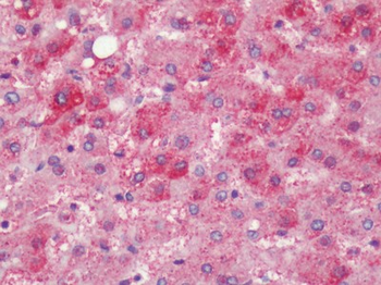 PTGER4/EP4 Antibody