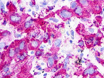 P2RY1/P2Y1 Antibody