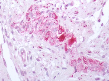 OXTR/Oxytocin Receptor Antibody