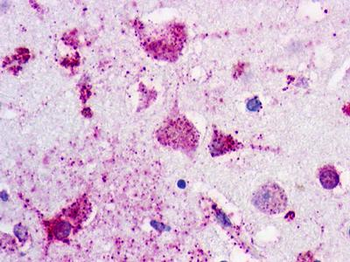 P2RY1/P2Y1 Antibody