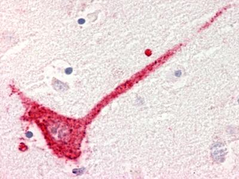 GPR182/ADMR Antibody