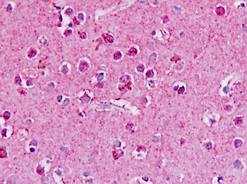 GPR182/ADMR Antibody