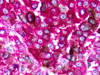 NMUR1 Antibody