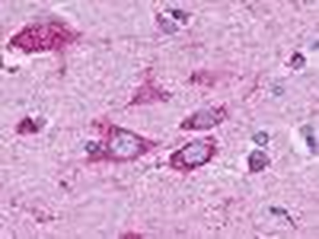 GPR37L1 Antibody