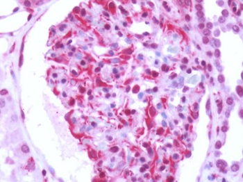 RAIG2/GPRC5B Antibody