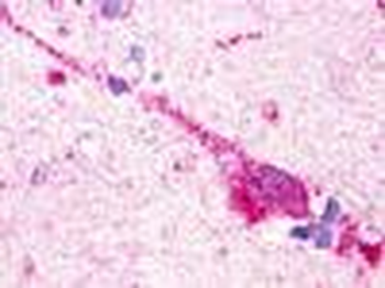 GPR174 Antibody
