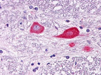GPR151 Antibody