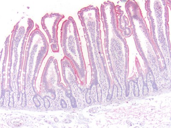 ADRB3 Antibody