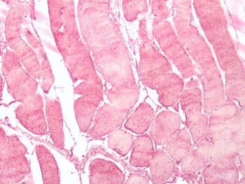 NMUR2 Antibody