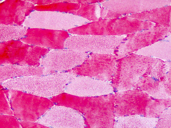 GPER1/GPR30 Antibody