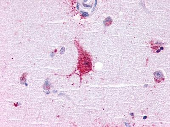 LGR6 Antibody