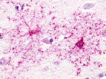 GPR52 Antibody