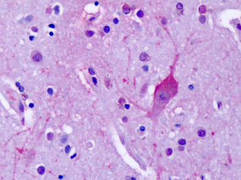 GRM4/MGLUR4 Antibody