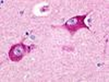 HRH3/Histamine 3 Receptor Antibody