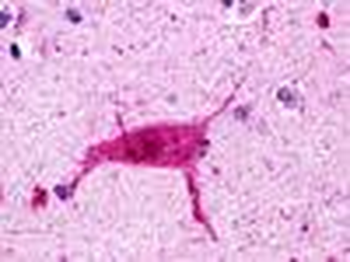 HRH3/Histamine 3 Receptor Antibody