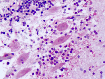 FZD8/Frizzled 8 Antibody