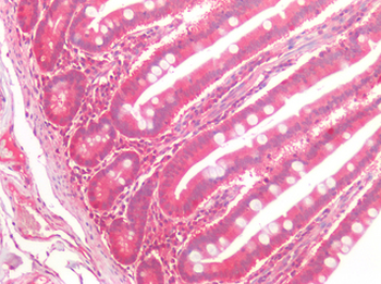 FZD7/Frizzled 7 Antibody