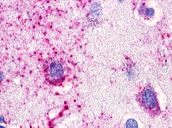 GPR173/SREB3 Antibody