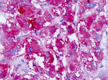 CELSR1 Antibody