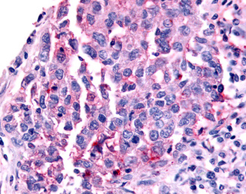 NR0B2 Antibody