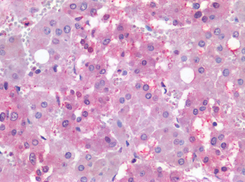NR5A1/SF1 Antibody