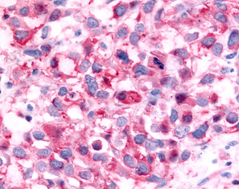 NR6A1/GCNF Antibody