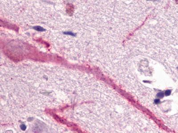 GPR160 Antibody