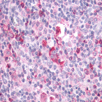 APLNR/ Apelin Receptor/APJ Antibody