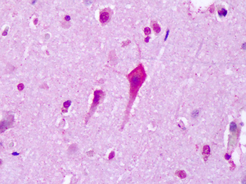 HTR7/5HT7 Receptor Antibody