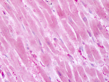 PTPRA/RPTP-Alpha Antibody