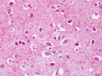 PTPRA/RPTP-Alpha Antibody