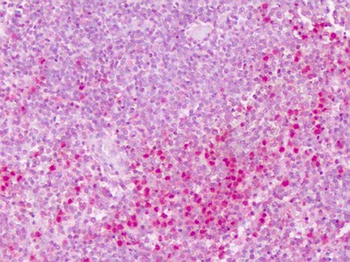 PTPRE/PTP Epsilon Antibody