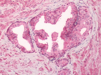 GPR55 Antibody
