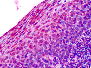 ADORA3/Adenosine A3 Receptor Antibody
